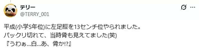 《鎌鼬消失了》曾經是盛行日本的妖怪 最近卻沒聽說有人被牠割傷了？｜高清图片集