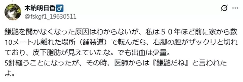 《鎌鼬消失了》曾經是盛行日本的妖怪 最近卻沒聽說有人被牠割傷了？｜高清图片集