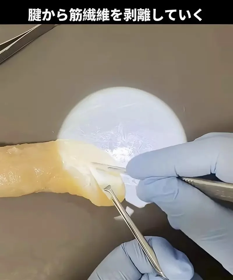 外科醫生處理雞柳條上的筋膜 以完全手術規格去除的影片吸引無數網友觀看｜高清图片集