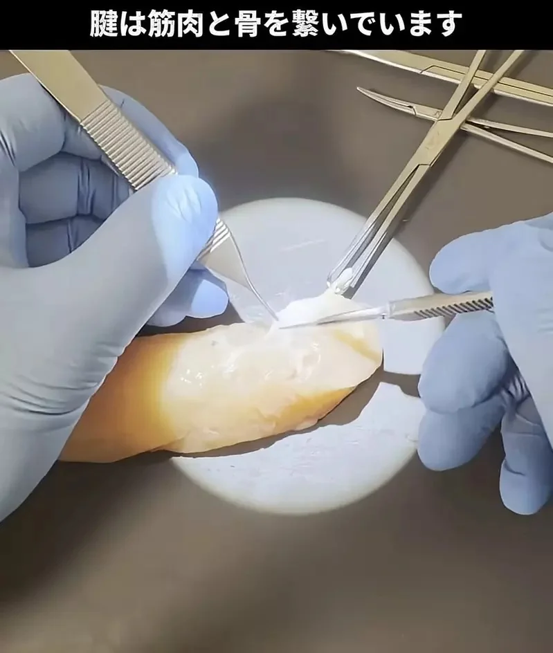 外科醫生處理雞柳條上的筋膜 以完全手術規格去除的影片吸引無數網友觀看｜高清图片集